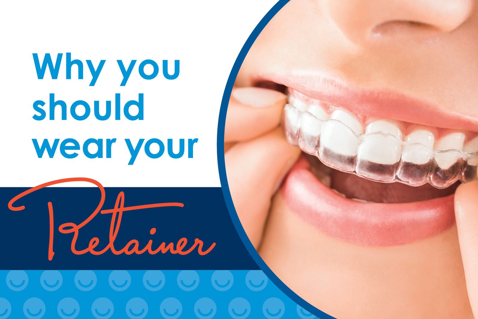 Retainers Show The Importance of Retainers | Great Smiles Orthodontics